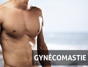 Gynécomastie