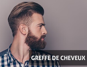 Greffe de Cheveux