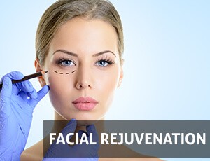 Facial Rejuvenation