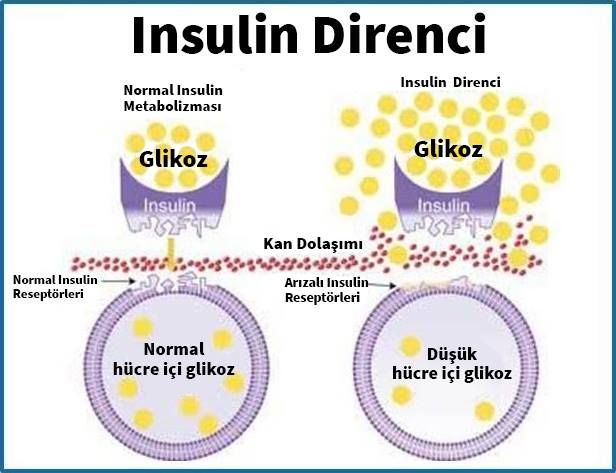 insulin-direnci