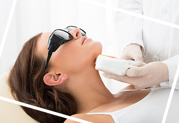 Besenreisser- Behandlung mit dem laser 4