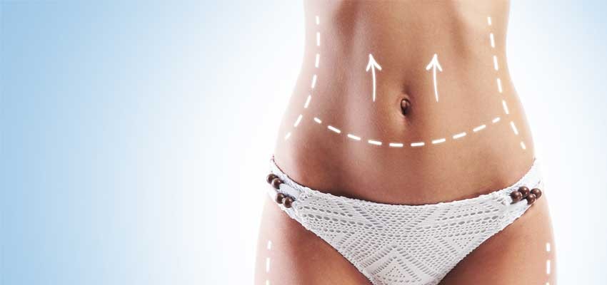 Vaser Liposuction Ameliyatı