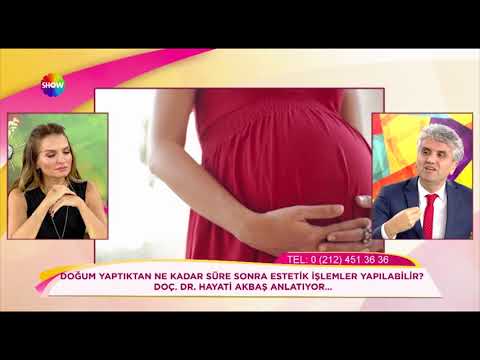 Doç. Dr. Hayati Akbaş - Doğumdan sonra ne zaman estetik operasyon yaptırmalıyız ? Show TV