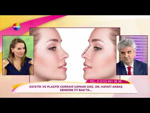 Doç. Dr. Hayati Akbaş-Düğün Öncesinde En Çok İstenen Estetik Operasyonlar Nelerdir ? -ShowTv