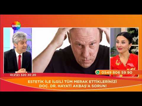 Doç. Dr. Hayati Akbaş-Ekilen Saçlar Dökülür mü?- Show Tv