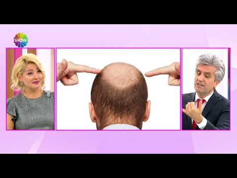 Doç. Dr. Hayati Akbaş -Ekilen Saçlar Ne Zaman Uzamaya Başlar ? ShowTv