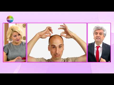 Doç. Dr. Hayati Akbaş - Erkek Tipi Saç Dökülmesi Ne Demektir ? Show Tv