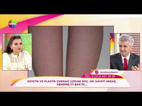 Doç. Dr. Hayati Akbaş - Liposuction Sonrası Emboli Riski Var mıdır?