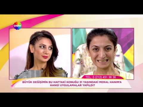 Doç. Dr. Hayati Akbaş - Meral Hanım'a Yaptığı Uygulamaları Anlatıyor ? Show Tv