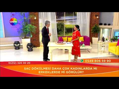 Doç. Dr. Hayati Akbaş-Ne Zaman Saç Ekimi Yapılmalıdır?- Show Tv