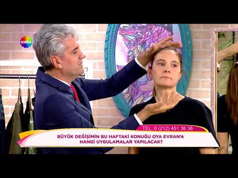Doç. Dr. Hayati Akbaş Oya Hanım'a Uygulayacağı Operasyonları Anlatıyor - Show TV