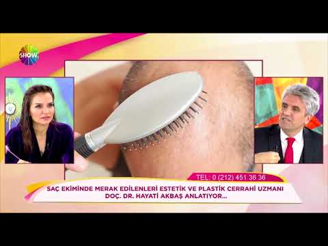 Doç. Dr. Hayati Akbaş - Saç dökülmesinin ana sebebi nedir? Show TV