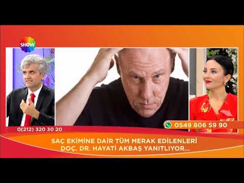 Doç. Dr. Hayati Akbaş-Saç Ekimi Operasyonlarında Kaç Seans Yeterlidir ?- Show Tv