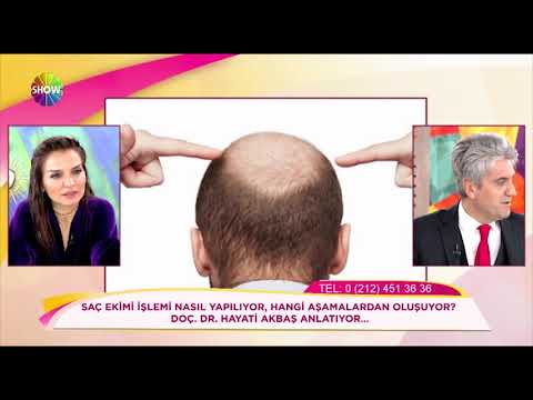 Doç. Dr. Hayati Akbaş-Saç ekiminde en önemli olan olgu nedir? Show TV