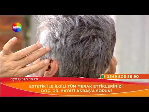 Doç. Dr. Hayati Akbaş-Saç Ekimini Etkileyen Faktörler Nelerdir?- Show Tv