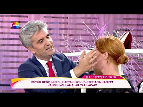 Doç. Dr. Hayati Akbaş Tatiana Hanım'a yapacağı estetik operasyonları anlatıyor - ShowTV