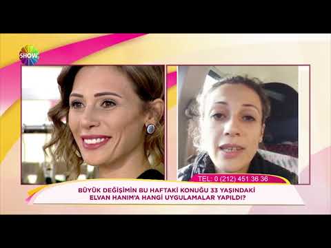 Doç.Dr. Hayati Akbaş Elvan Hanım’a yaptığı uygulamaları anlatıyor. Show TV