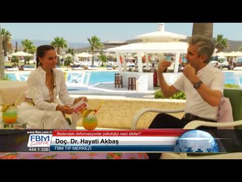 Doç.Dr.Hayati Akbaş-Bedende ki deformasyonlar psikolojiyi nasıl etkiler?-Show Tv