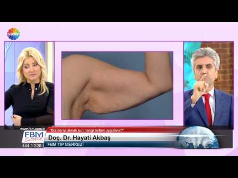Doç.Dr.Hayati Akbaş -Bol deriyi almak için hangi tedavi uygulanır?- Show Tv