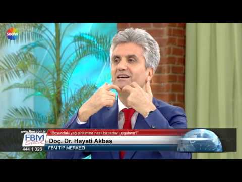 Doç.Dr.Hayati Akbaş -Boyundaki yağ birikimine nasıl bir tedavi uygulanır?- Show Tv