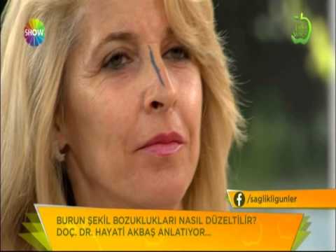 Doç.Dr.Hayati Akbaş-Burun Estetiği-Show Tv
