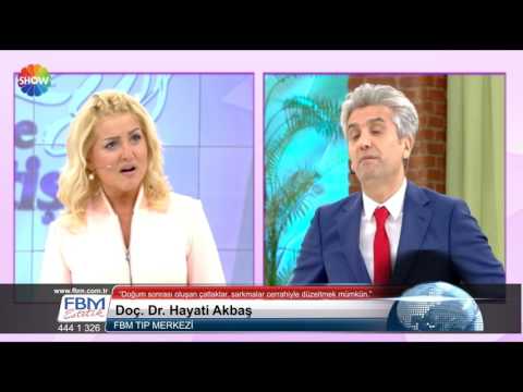 Doç.Dr.Hayati Akbaş - Doğum sonrası oluşan çatlaklar sarkmalar cerrahiyle düzeltilebilir - Show Tv