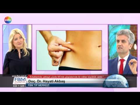 Doç.Dr.Hayati Akbaş -Erkeklerin yüzde 65'inde göğüslerinde bir miktar büyüklük vardır- Show Tv