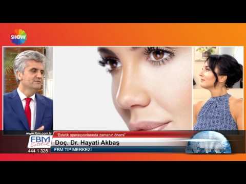 Doç.Dr.Hayati Akbaş-Estetik operasyonlarında zamanın önemi-Show Tv