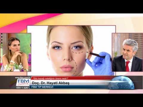 Doç.Dr.Hayati Akbaş-Göz kapağı estetiğinin önemi nedir?-Show Tv