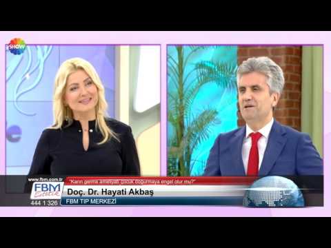 Doç.Dr.Hayati Akbaş -Karın germe ameliyatı çocuk doğurmaya engel olur mu?- Show Tv