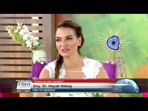 Doç.Dr.Hayati Akbaş -Kimlere saç ekimi yapılabilir? Show Tv