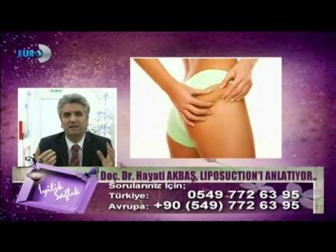 Doç.Dr.Hayati Akbaş - Liposuction - Euro D