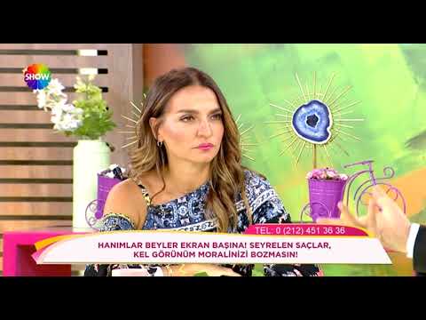 Doç.Dr.Hayati Akbaş-Saç dökülmesi insanları nasıl etkiler?-Show Tv