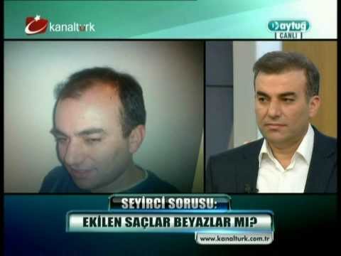 Doç.Dr.Hayati Akbaş - Saç Ekimi - Kanaltürk - Dr. Aytuğ