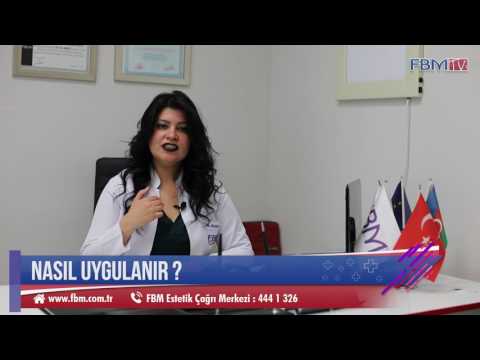 Dr. Hülya Ettekin "Karbon Peeling" anlatıyor.