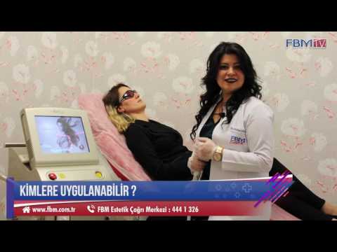 Dr. Hülya Ettekin "Lazer Epilasyon'da Kullanılan Buz Lazeri" anlatıyor.